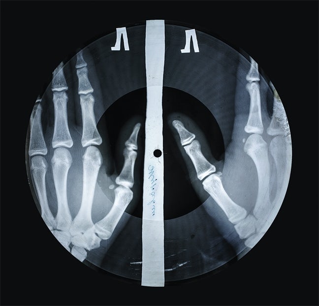 X-Ray Audio
